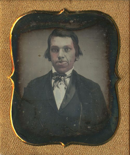 You Should Have Seen the Other Guy! Sixth Plate Hand Tinted Daguerreotype